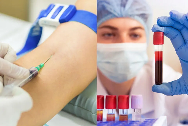 Análisis de sangre abre la puerta para diagnosticar la fatiga crónica