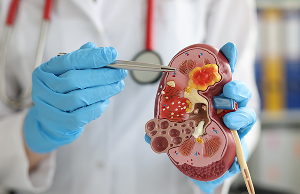 Un fármaco contra el estreñimiento ayuda a la función renal