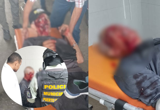 Accidente-en-bicicleta-deja-a-adulto-mayor-herido-en-importante-vía-de-Puerto-Cabello