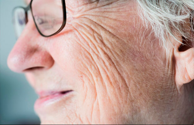 Existen-varios-tipos-de-arrugas---Loreal-Paris-nos-ayuda-a-identificarlas-y-cómo-tratarlas