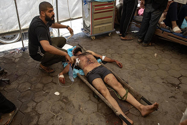 OMS la guerra en Gaza ha causado 42 mil lesiones graves, incluidas 5 mil amputaciones