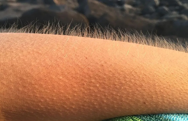 Por qué se pone la piel de gallina al escuchar música emotiva o sentir miedo