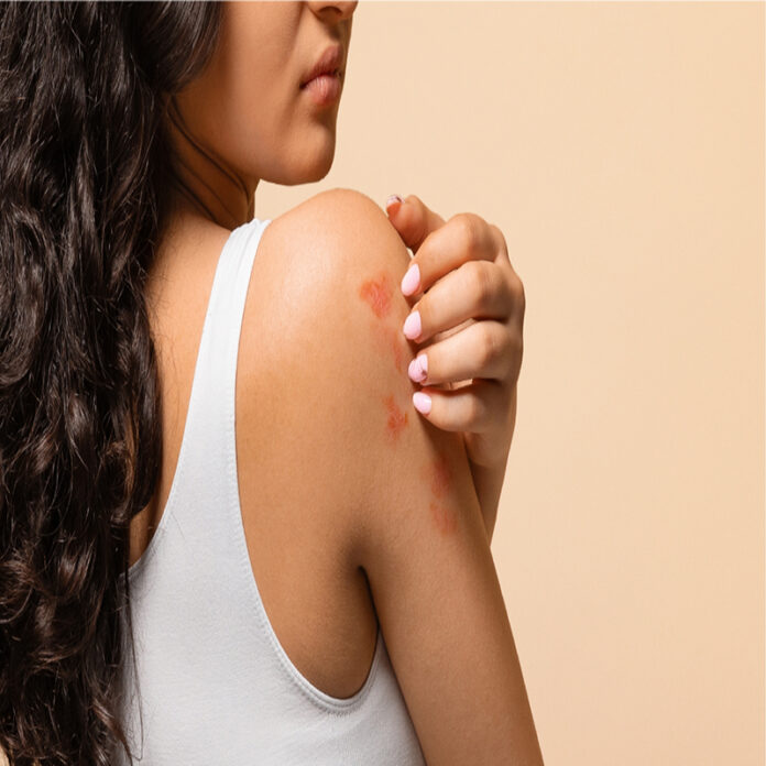 Redes sociales y estrés, factores que impactan la salud dermatológica en Venezuela