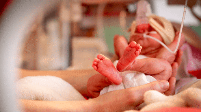 Registran-tasa-del-70-%-de-nacimientos-prematuros-en-Monagas