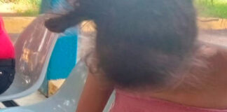 Mujer maltratada irrumpe en CDI con heridas y moretones