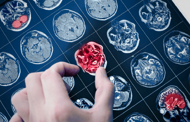 Descubren-cómo-las-células-tumorales