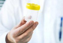 Detectan el primer caso de transmisión de una enfermedad rara mediante donante de esperma