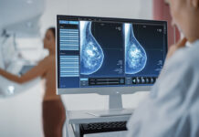 El uso de IA en mamografías permite anticipar el riesgo cardiovascular en mujeres