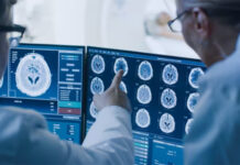 Hallan una nueva vía para intentar frenar la enfermedad de Huntington