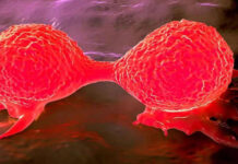 Investigación revela que el cáncer de mama utiliza el glutatión como despensa