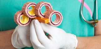 La paradoja del colesterol: Bajar mucho sus niveles es tan riesgoso como tenerlo alto