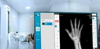 Reactivarán el servicio de radiología en Guárico