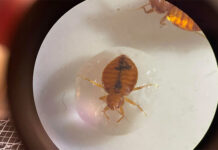 Una nueva técnica se muestra prometedora para administrar algunos fármacos para el cáncer