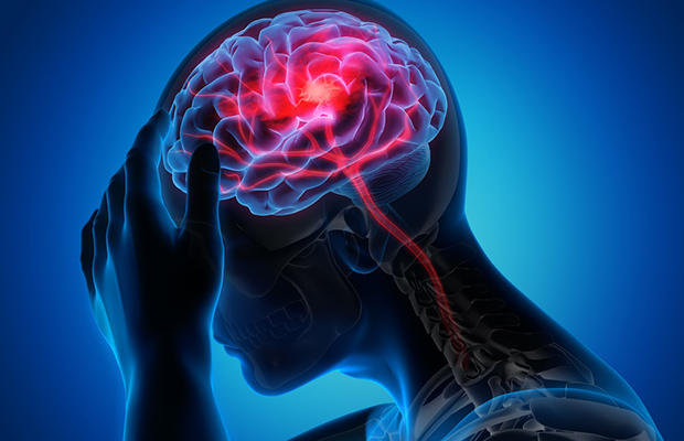 Uso de la IA reduce recurrencia de los ACV en un 27%