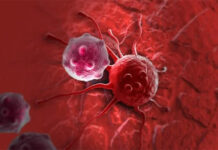 Cáncer colorrectal en jóvenes: vinculan la dieta, el tabaco y los pesticidas con el aumento de casos