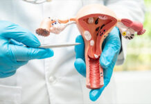 Cáncer de cuello uterino es la segunda causa de muerte oncológica en mujeres