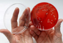 Científicos prueban un método con IA para tratar superbacterias resistentes a antibióticos