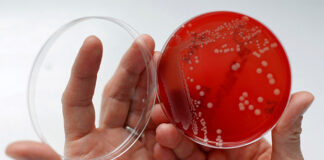 Científicos prueban un método con IA para tratar superbacterias resistentes a antibióticos