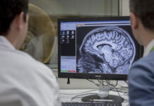 Científicos revelan cómo el entorno acelera o frena el envejecimiento del cerebro