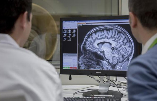 Científicos revelan cómo el entorno acelera o frena el envejecimiento del cerebro