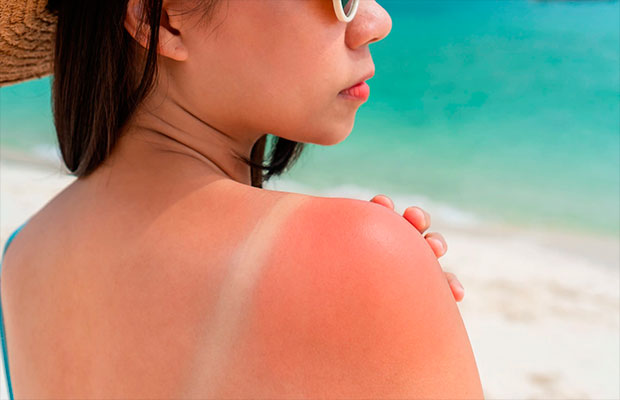 Cómo-aclarar-tu-piel-después