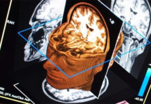 Desarrollan una plataforma que detecta el alzhéimer de forma precoz a través de la voz