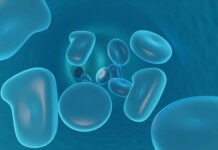 Un estudio identifica dos fases clave en el origen de la leucemia infantil