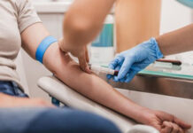 Un nuevo método avanza hacia la detección del cáncer con un análisis de sangre