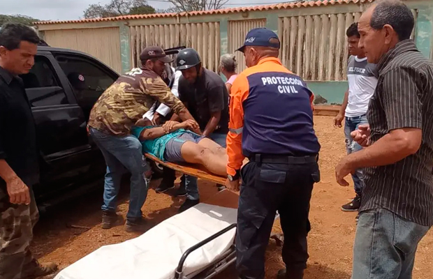 Dos-hermanos-resultaron-lesionados-en-deslizamiento-de-moto-en-Falcón