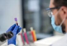 Dos nuevos tipos de pruebas pueden detectan antes algunos biomarcadores del alzhéimer
