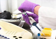El ocrelizumab ralentiza la esclerois múltiple progresiva en pacientes avanzados y mayores