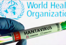 OMS: No hay razones para que el brote de hantavirus se convierta en una gran epidemia
