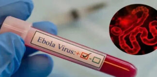 OMS eleva a más de 900 casos sospechosos o confirmados de ébola en la RDC