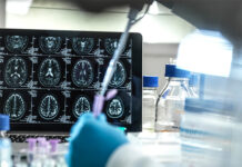 Un estudio internacional descubre una nueva vía para desarrollar fármacos contra el cáncer