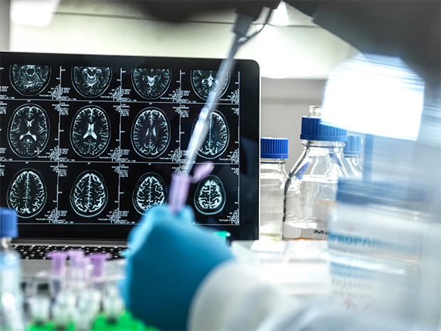 Un estudio internacional descubre una nueva vía para desarrollar fármacos contra el cáncer