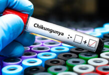 El Instituto Pasteur trabaja en una nueva vacuna contra el chikungunya con fondos de la UE
