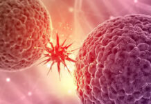 92% de la población mundial se verá afectada por el cáncer, según la OMS