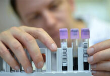 Hepatitis C puede curarse en hasta 95 % de casos