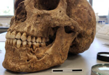 Identifican en Israel la herida por violencia más antigua conocida en una mandíbula de 90.000 años