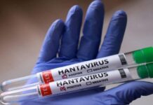 Ministerio de Salud confirmó 3 fallecidos por Hantavirus en Anzoátegui (+Comunicado)