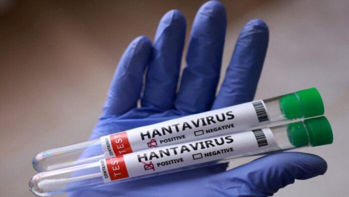 Ministerio de Salud confirmó 3 fallecidos por Hantavirus en Anzoátegui