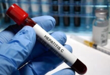 OMS: muertes por hepatitis siguen sin bajar, en contraste con el sida o la tuberculosis