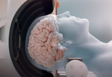 Un compuesto de origen vegetal podría abrir nuevas vías para abordar el daño cerebral del Alzheimer
