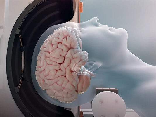 Un compuesto de origen vegetal podría abrir nuevas vías para abordar el daño cerebral del Alzheimer