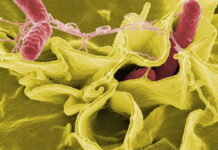 Brote de salmonelosis en el Reino Unido podría tener su origen en Ucrania