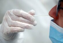 Julio Castro alerta sobre aumento de influenza y covid-19 en Caracas