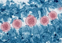 Michigan registra las dos primeras muertes del brote ciclosporiasis en EEUU