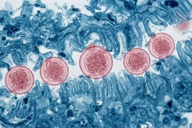 Michigan registra las dos primeras muertes del brote ciclosporiasis en EEUU