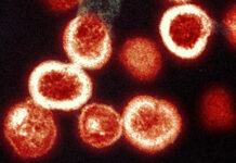 Triple tratamiento de fármacos podría eliminar el VIH en monos bebé