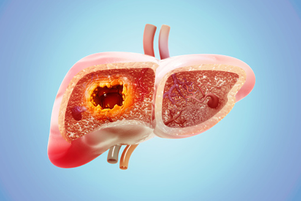 Un equipo belga da con la forma de revertir un mecanismo que blinda el cáncer en el hígado